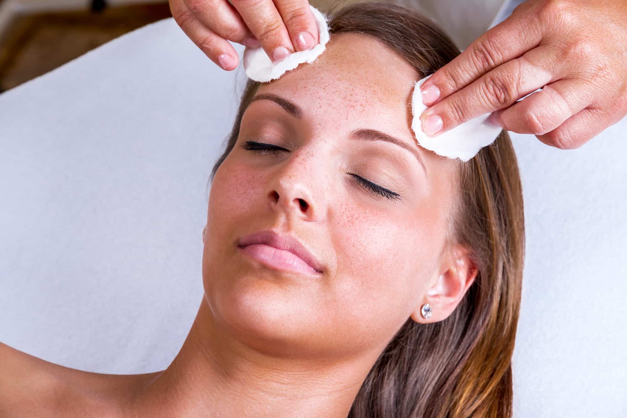chemical skin peels sheffield