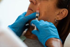 Administering Profhilo