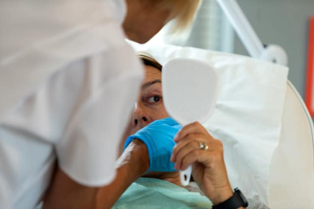 chemical skin peels sheffield