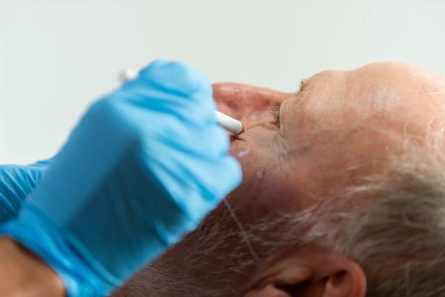 men botox south yorkshire, botox men south yorkshire, botox men sheffield, botox men barnsley