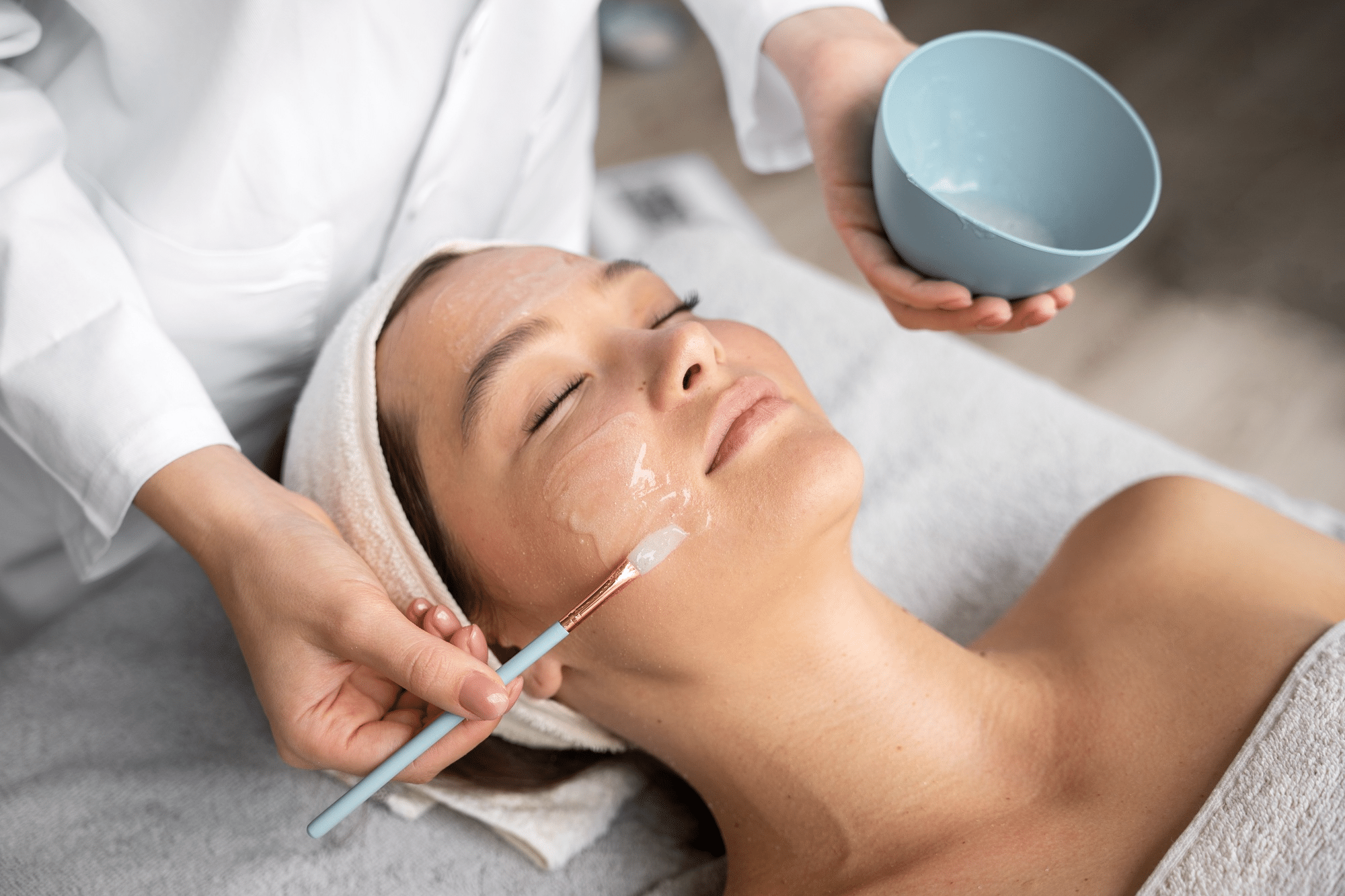 chemical peel